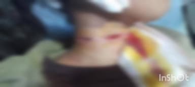 આણંદ શહેર: સાંગોળપુરા વિસ્તારમાં એકટીવા લઈને જતી સગીરાનું પતંગની દોરીથી ગળું કપાયું, હાલ લોકોએ જાગૃતતા દાખવવી જરૂરી