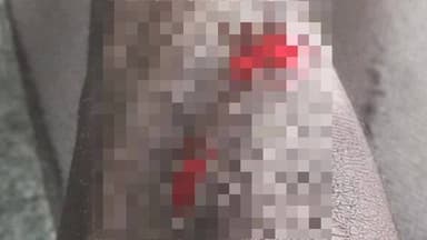 ডায়মন্ডহারবার ২: ডায়মন্ড হারবার দু'নম্বর ব্লক তামাকের ঠেস এলাকায় দুটি বাইকের মুখোমুখি সংঘর্ষে আহত এক বাইক আরোহী