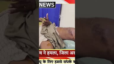 छेला खेरवाड़ा के जंगलात में बुजुर्ग पर वन्य जीव का हमला #newsalert #hindinews