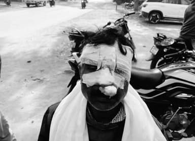 पिंड्रा: फूलपुर में हैंडपंप विवाद के चलते जमकर हुई मारपीट, चार लोग गंभीर रूप से घायल, पुलिस ने दर्ज किया मुकदमा