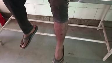 चंदिया: सिंमडारी में पागल कुत्ते का आतंक, युवक पर किया हमला