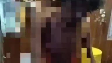 ଓରିଏଣ୍ଟ: ତିଳିଆ ପଞ୍ଚାୟତର ଗୌରପଡା ଗ୍ରାମରେ ଶୋଇଥିବା ସମୟରେ ନିଆଁରେ ପୋଡ଼ି ଗୁରୁତର ଆହତ