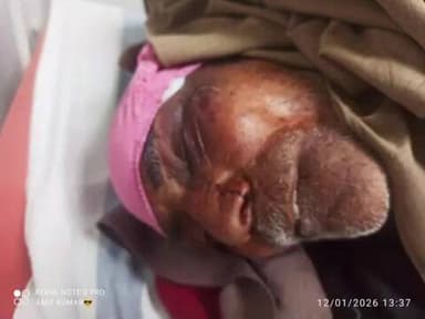 शेखोपुर सराय: सीढ़ी निर्माण विवाद में भतीजे का जानलेवा हमला, चाचा-चाची समेत तीन गंभीर