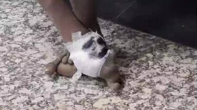 संदेश: रेपुरा के पास मानवता की मिसाल: सड़क किनारे पड़े अज्ञात विक्षिप्त को लोगों ने अस्पताल पहुंचाया और कराया इलाज