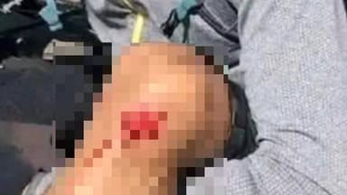 মন্দিরবাজার: চাঁদপুর এলাকায় বাইক ও সাইকেলের সংঘর্ষে আহত সাইকেল আরোহী