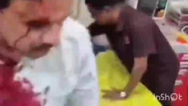 कल्याण: केडीएमसी निवडणुकीच्या प्रचारादरम्यान शिंदे आणि भाजपचे कार्यकर्ते आमने-सामने, अनेक कार्यकर्ते रक्तबंबाळ