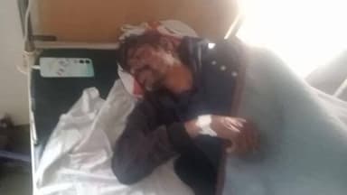 मझौली: सीधी जिले के मझौली में जमीनी विवाद में मारपीट, एक व्यक्ति घायल, अस्पताल में इलाज जारी