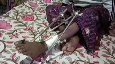 তুফানগঞ্জ ১: টোটো উল্টে পা চার টুকরো হয়ে যাওয়া ঘোগারকুটি এলাকার বাসিন্দা টোটো চালকের পাশে চিলাখানা ২GP INTTUC সভাপতি