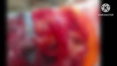 पिपलाकछार मड़ई में चाकू से जानलेवा हमला, युवक गंभीर रूप से घायल