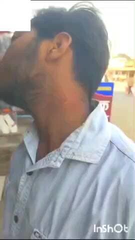 मेजा: मेजा रोड पुलिस चौकी के समीप चाइनीज मांझे की चपेट में आने से युवक का गला व अंगुली कटी, इलाज के लिए भेजा गया अस्पताल