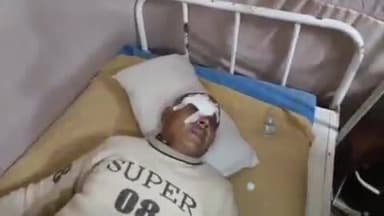 फर्रुखाबाद: लकड़ी फाड़ते समय कल्पवासी के सिर में लगी कुल्हाड़ी, मेला श्रीरामनगरिया में बने अस्पताल में कराया गया भर्ती