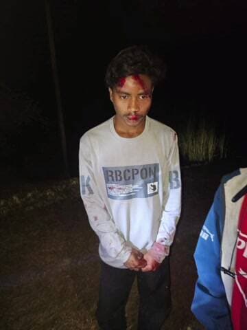 झींकपानी: झींकपानी-सेरेंगबिल पुल के पास मोटरसाइकिल सवारों ने पैदल युवक को मारी टक्कर, दो घायल