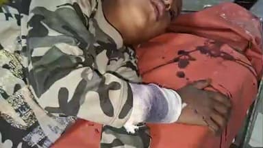 संदेश: तीर्थकॉल में पेड़ के ऊपर से अचानक गिरकर मासूम बच्चा हुआ जख्मी, दर्द से तड़पकर रोने लगा