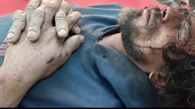 बलिया: एनएच-31 पर अज्ञात वाहन की टक्कर से एक व्यक्ति गंभीर रूप से घायल