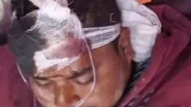 गोला: गोला में युवक गंभीर घायल, रामजानकी मार्ग पर बाइक दुर्घटना में हालत नाजुक