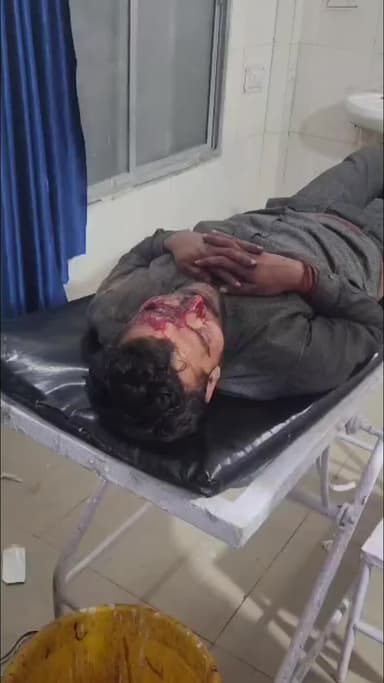 लिधौरा: बछौड़ा के पास सड़क हादसे में बाइक चालक घायल, मुंह में आई चोट, उपचार जारी