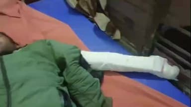 बिसवां: थानगांव देवरिया मार्ग पर हुए सड़क हादसे में बाइक सवार युवक गंभीर रूप से घायल