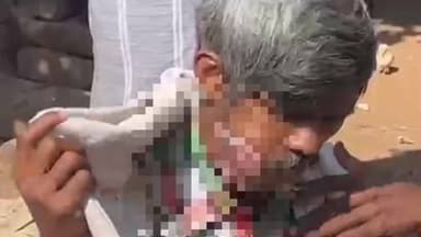 डंडई: झोलाछाप इलाज से बिगड़ी युवक की हालत, गलत उपचार से डंडई का मजदूर जिंदगी और मौत से जूझ रहा, स्वास्थ्य विभाग पर सवाल