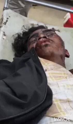 चतरा: चिरैंया मोड़ के पास बाइक दुर्घटना, तीन युवक घायल, एक को रांची रेफर