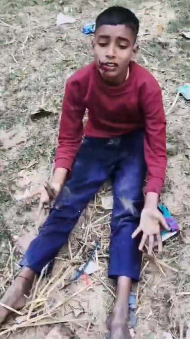 चांदी गांव में किराना दुकानदार पर किशोर से बेरहमी से मारपीट का आरोप, 12 वर्षीय बच्चा गंभीर रूप से घायल..........
#sheikh...