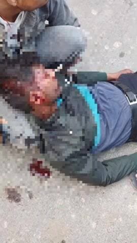 पयागपुर: जगदीशपुर चौराहे के पास दो बाइकों की आमने-सामने भिड़ंत, एक बाइक सवार की इलाज के दौरान हुई मौत