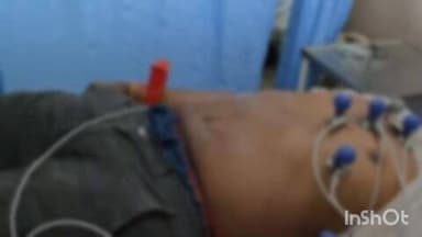 వికారాబాద్: లక్ష్మీదేవి పల్లి గేటు సమీపంలో రోడ్డు ప్రమాదం, ఒక వ్యక్తి మృతి మరో వ్యక్తికి తీవ్ర గాయాలు