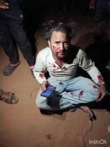 धमतरी: संबलपुर के पास ट्रक की टक्कर से बाइक सवार युवक घायल हुआ