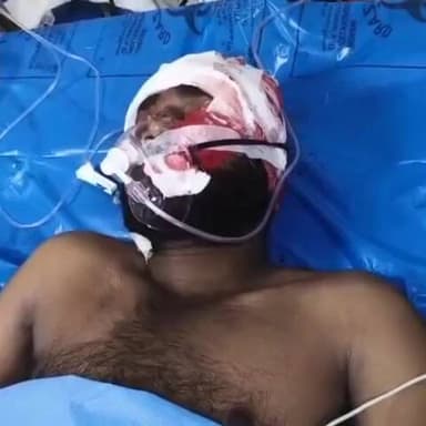 ಆಳಂದ: ಧುತ್ತರಗಾಂವ ಗ್ರಾಮದಲ್ಲಿ ಕಬ್ಬು ಕಡಿಯುವ ಕತ್ತಿಯಿಂದ ಯುವಕನ ಮೇಲೆ ಹಲ್ಲೆ: ಸ್ಥಿತಿ ಗಂಭೀರ