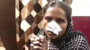 बिसवां: रेउसा थाना क्षेत्र के मंसब खां पुरवा गांव में नाराज पति ने पत्नी की चाकू से काटी नाक, पुलिस कर रही कार्रवाई