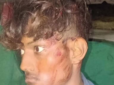 लंभुआ: लंभुआ में पुरानी रंजिश के चलते युवक की पिटाई, जाति सूचक गाली देने का आरोप, पुलिस को दी तहरीर