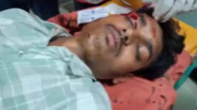 उदवंत नगर: धमार मोड़ के समीप नशे में बाइक चलाना पड़ा भारी, सड़क हादसे में दो दोस्त घायल, पुलिस ने भेजा जेल