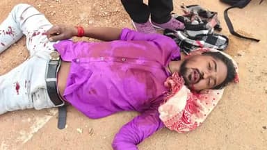 पत्थलगड्डा: पत्थलगड़ा में भीषण सड़क हादसा, बलबल मेला देखकर लौट रहे तीन युवक गंभीर रूप से घायल