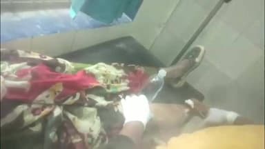 देवेंद्रनगर: बकरी चराने जंगल गई महिला पर तेंदुए का हमला, महिला गंभीर रूप से घायल