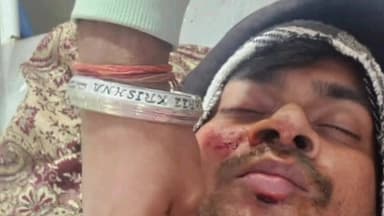 सिरसागंज: हाईवे स्थित नगला राधे मोड़ पर स्कूटी फसने से युवक गंभीर रूप से घायल, इलाज के लिए अस्पताल में भर्ती कराया गया