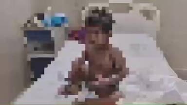 पयागपुर: गोगेपुरवा गांव में खोलते तेल में गिरने से मासूम झुलसी, हालत गंभीर, मेडिकल कॉलेज किया गया रेफर