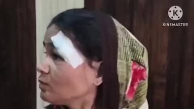 पट्टी: नचरौला गांव में बेटी को पिता से दूध मांगना पड़ा महंगा, पिता ने मां-बेटी को पीटकर किया घायल