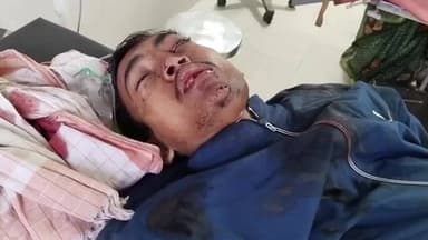 आरा: तेज रफ्तार बाइक के कारण एक युवक बकरी के समीप बुरी तरह जख्मी, नाजुक हालत में पीएमसीएच किया गया रेफर