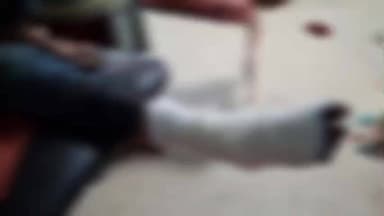 संदेश: रेपुरा के समीप ट्रक को चकमा देने के कारण बाइक सवार अनियंत्रित होकर सड़क पर पलटा, युवक गंभीर रूप से जख्मी