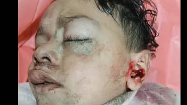 बिलारी: मैनाठेर में ट्रैक्टर की चपेट में आने से बच्चा घायल, गंभीर हालत में निजी अस्पताल में भर्ती, प्राथमिकी दर्ज