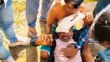 करेली: ग्राम करौदी में तेज रफ्तार वाहन ने युवक को मारी टक्कर, युवक गंभीर रूप से घायल, अस्पताल में भर्ती