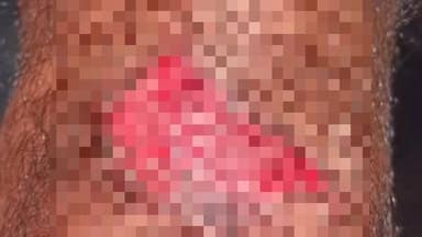 মন্দিরবাজার: নিশাপুর এলাকায় বাইক ও সাইকেলের সংঘর্ষে আহত সাইকেল আরোহী