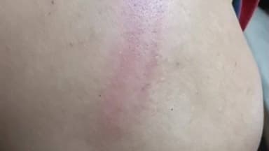 નડિયાદ: ઉતરસંડામાં દબાણ હટાવવા મુદ્દે બાપ દીકરાનો એક યુવક ઉપર હુમલો.