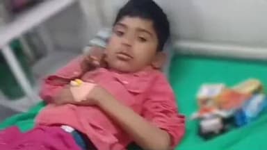 जिंतूर: कौसडी येथे वानराच्या हल्ल्यात बालक जखमी जिल्हा रुग्णालयात उपचार सुरू