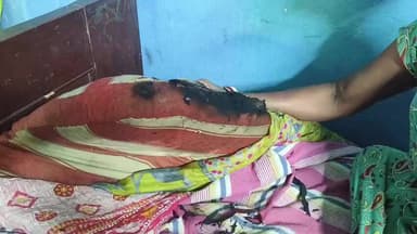 কৃষ্ণনগর ১: কৃষ্ণনগরে রহস্যজনক অগ্নিকাণ্ড—হঠাৎ করেই ঘরে ঘরে জ্বলে উঠছে আগুন, আতঙ্কে পরিবারের লোকজন, চাঞ্চল্য ছড়িয়েছে এলাকায়