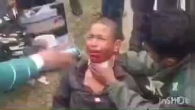 तुलसीपुर: पचपेड़वा के पास सशस्त्र सीमा बल के डॉक्टरों ने घायल किशोर की जान बचाई