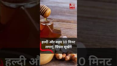 Valentine's Day से पहले पिंपल जल्दी कैसे हटाएं? | #shorts #skincare