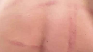 गोला: बड़हलगंज थाने के दरोगा पर मारपीट और ₹50 हजार रिश्वत लेने का आरोप, पति-पत्नी विवाद में थाने बुलाकर युवक से की गई बर्बरता