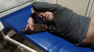 कानपुर: कल्याणपुर में युवक ने पेट्रोल डालकर आत्मदाह का प्रयास किया, गंभीर हालत में भर्ती