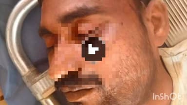 सोरांव: सोरांव थाना क्षेत्र के सेवइथ में बहनोई ने साले की की मारपीट, घायल की उपचार के दौरान हुई मौत