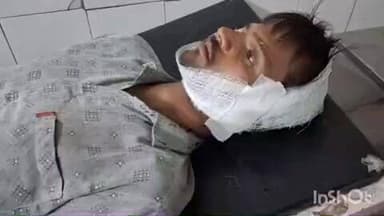 मड़ावरा: सेमरखेड़ा में चने का होला खाने गए एक ग्रामीण का विवाद के दौरान पड़ोसी ने दांतों से कान काटकर किया अलग